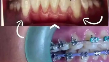 Clinica Dental - Dentaliz (dentalli) - Ortodoncia - Dentistas en Ometepec - Dentistas Guerrero - Barrio De La Cruz Chiquita