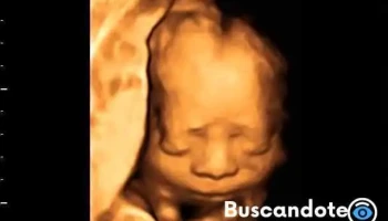 Criv - Centro de Radiología e Imagen de Villahermosa - Av Niños Héroes 196