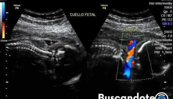 Plaza de la Salud - -97.962120