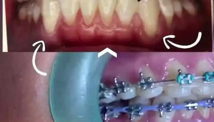 Clinica Dental - Dentaliz (dentalli) - Ortodoncia - Dentistas en Ometepec - Dentistas Guerrero - Barrio De La Cruz Chiquita