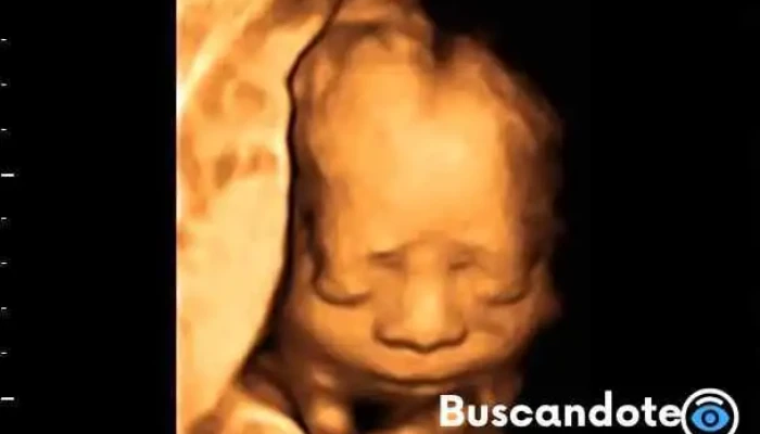 Criv - Centro de Radiología e Imagen de Villahermosa - Av Niños Héroes 196