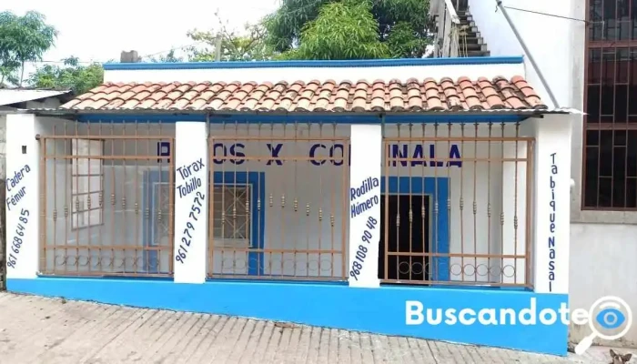 Rayos X Copainala - Santa Cecilia